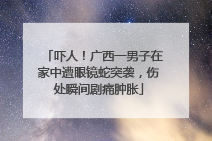吓人！广西一男子在家中遭眼镜蛇突袭，伤处瞬间剧痛肿胀