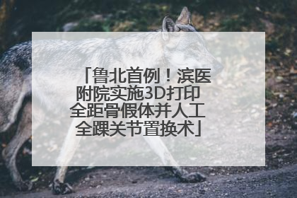 鲁北首例！滨医附院实施3D打印全距骨假体并人工全踝关节置换术